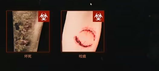 边境丧尸检察官